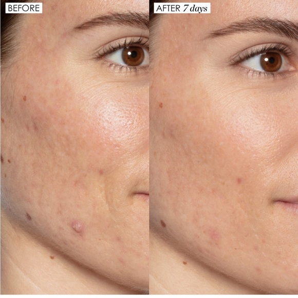 Good Genes - Sunday Riley - Picture 4 of 5